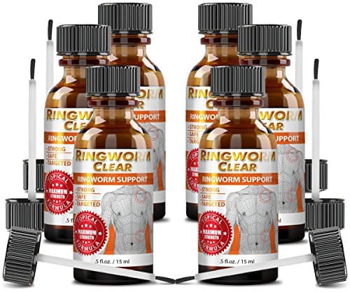Ringworm Clear - Clear your Ringworm Today with the best Supplement available on the market - 6 Bottles