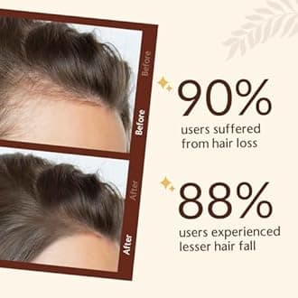 Anagain 3%, Procapil 3%, Redensyl 2%, Capilia Longa 1%, Biotin, Caffeine Advanced Hair Growth Serum (50 Ml) With Natural Ingredients, Reduce Hair Fall & Hair Thinning