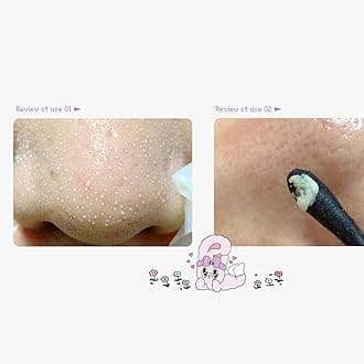 ilso Natural Mild Clear Nose Patch, Melt blackheads & Tighten Pores, no irritation, Korean skincare, cotton swabs included, 5 sheets (Esther Bunny Limited Edition) (PINK Esther Bunny Limited Edition)