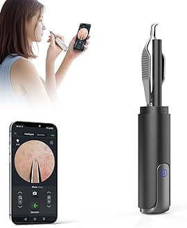 Blackhead Remover Tweezer with 1080P Camera, UV Light – USB Rechargeable Precision Tweezers for Ingrown Hair, Ear Hair, Eyebrows, Pore Extractor Tool for Men and Women (Black)
