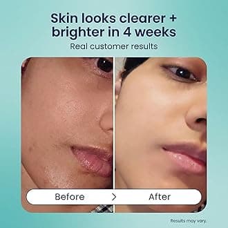 BOHO Cleansing Balm - Hydrating & Moisturizing Facial Cleanser & Makeup Remover Balm for All Types - Natural Deep Pore Cleanser with Vitamin E & Botanical Extracts (2oz)