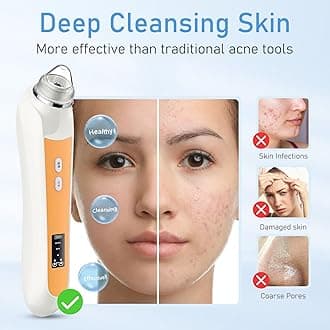 Adjustable Power Levels(Orange)